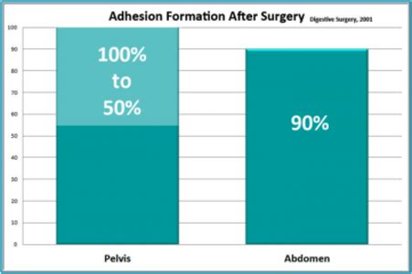 Pelvic Therapy for Endometriosis, Adhesions and Sexual Pain- Hormones Matter