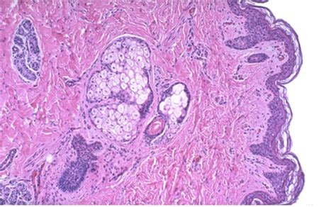 Derm And MSK Week 1 Flashcards Quizlet