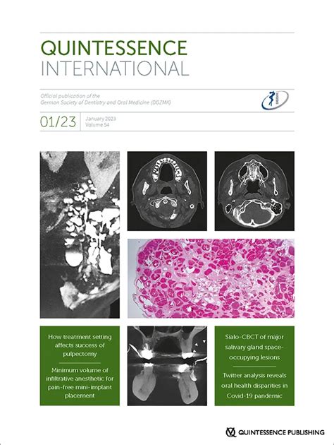 Radiographic Findings Of Space Occupying Lesions In Sialo CBCT Of The