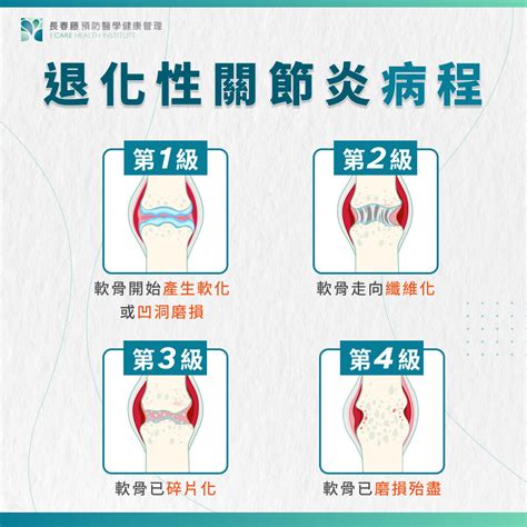 退化性關節炎如何改善？關節退化症狀、治療、保養大全 長春藤預防醫學