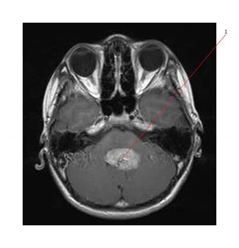 Pediatric Oncology Education Materials