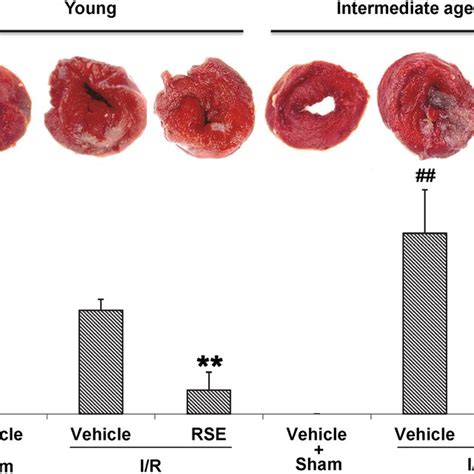 Myocardial Infarct Size Determined Using The Ttc Method Young And