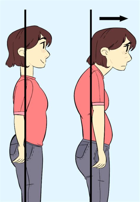 Way To Fix Forward Head Posture Best Way To Get Rid Of Forward Head