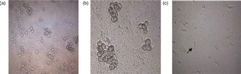 Light Micrograph Of Naegleria Cysts A × 100 B × 400 And Download Scientific Diagram