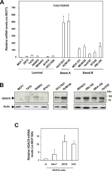 Hdac9 Is Overexpressed In The Most Aggressive Breast Cancer Cells A