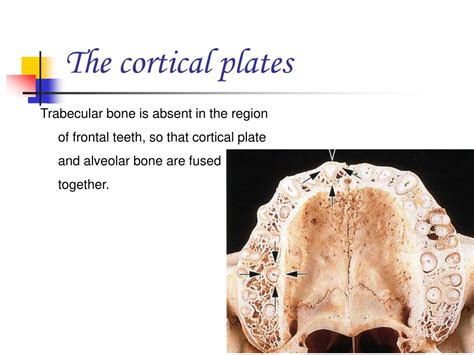 Ppt Pre Clinical Periodontics Powerpoint Presentation Free Download