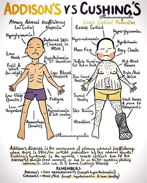 Journal Of Brown Hospital Medicine On Twitter Addisons Vs Cushings