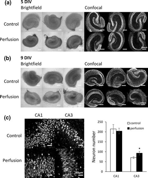 Morphology Of Organotypic Hippocampal Cultures Maintained In The