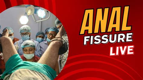 Understanding Anal Fissures Causes Symptoms And Treatment Options