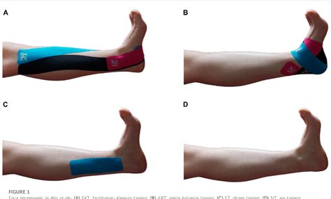 Acute Effect Of Kinesio Tape On Postural Control In Individuals With