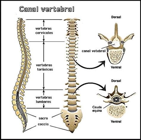 O Que Hemangioma Na Coluna Vertebral Wrocawski Informator