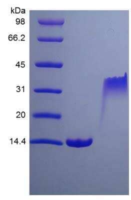 Rat Pdgf Bb Recombinant Protein Novus Biologicals