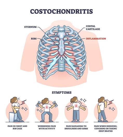 understanding sternum pain popping  effective exercises  relief