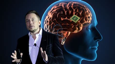 Elon Musk Asegura Que Ya Se Implant El Primer Chip Cerebral De