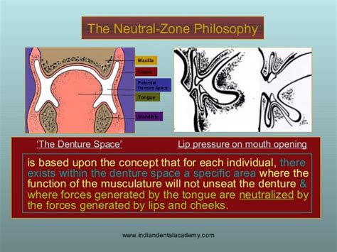 Concept Of Neutral Zone Dental Seminars