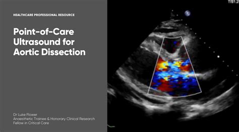 Point Of Care Ultrasound Pocus For Aortic Dissection