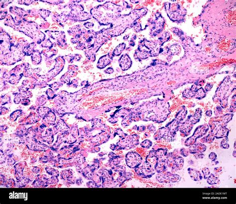 Light Micrograph Of A Human Placenta At Term Showing Small Chorionic Villi And A Large Stem