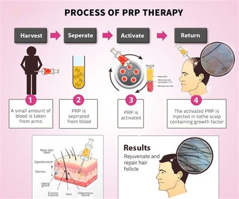 Plasma Rich Protein | Rederm Medical Center