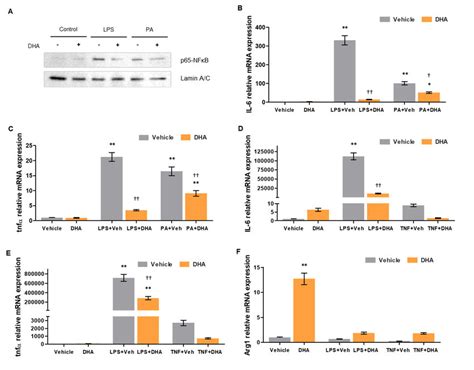 Effects of DHA on macrophage activity A p65 NFκB nuclear factor