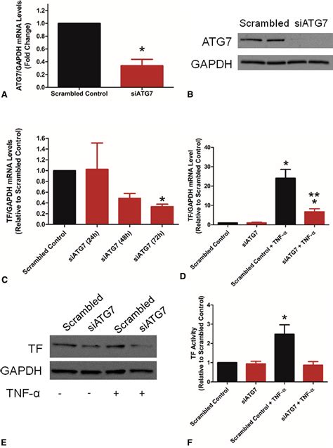 Endothelial Specific Deletion Of Autophagy Related Atg Attenuates