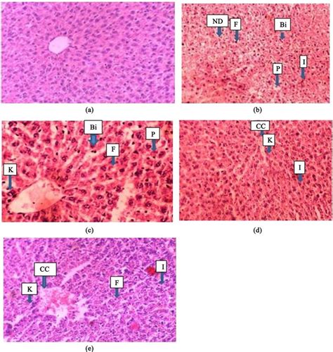 Photomicrograph Of Hematoxylin And Eosin Stained Section Of