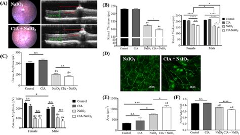 Naio Induced Retinal Degeneration Is Aggravated In The Presence Of