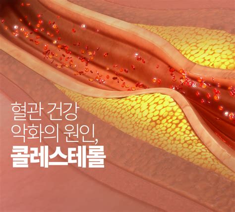 혈액이 잘 돌아야 건강하다 혈액순환 돕는 음식과 생활습관은 올바른 먹거리 북미 No 1 한인 병원 의사 약국 찾기