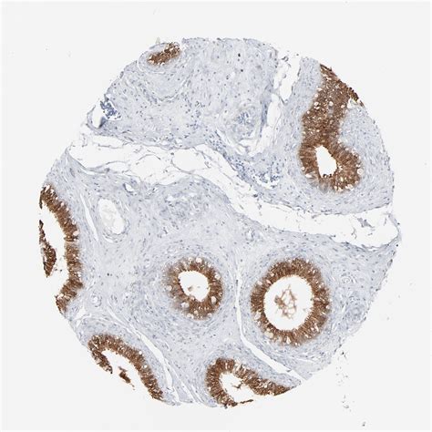 Tissue Expression Of Phgdh Staining In Epididymis The Human Protein