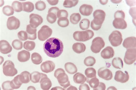 Neutrophil Microscope