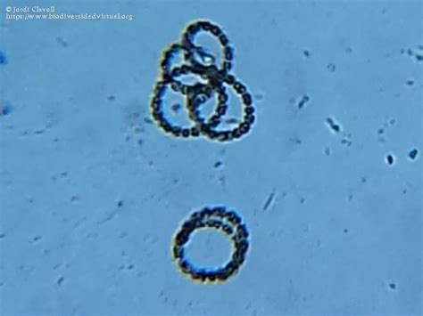 Anabaena Flosaquae Biodiversidad Virtual Mundo Microsc Pico