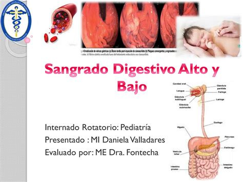 Sangrado Digestivo Alto Y Bajo Etiolog A Ppt