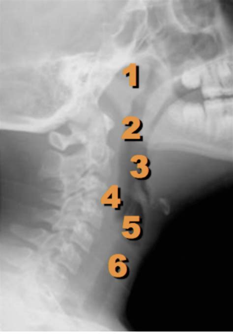 X Ray Soft Tissue Neck 2 Diagram Quizlet