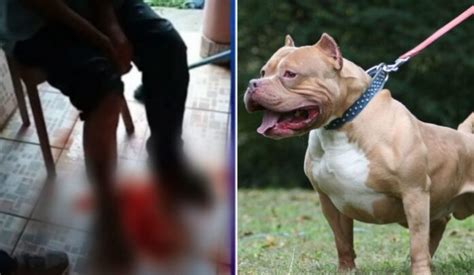 Perros Pitbulls Atacan A Tres Hombres En Lempira