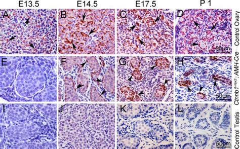 β Catenin Directs The Transformation Of Testis Sertoli Cells To Ovarian