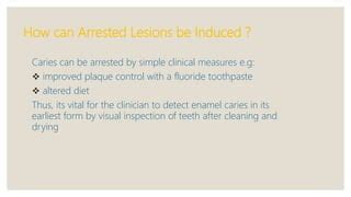 Early childhood caries, rampant, chronic and arrested caries | PPT