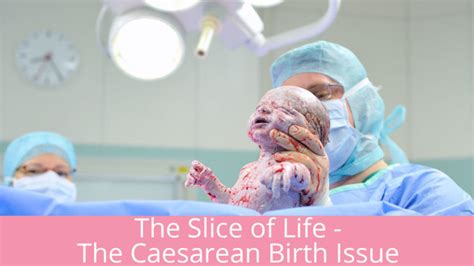 The Slice Of Life The Caesarean Birth Issue Sydney 2024