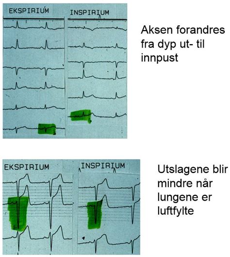 Index Of Elaring Fag Hjertesykdommer Images