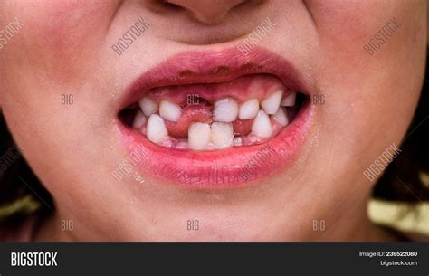 Portrait Toothless Image And Photo Free Trial Bigstock