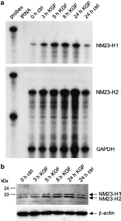 Kgf Regulated Expression Of Nm23 H1 And Nm23 H2 In Hacat Keratinocytes