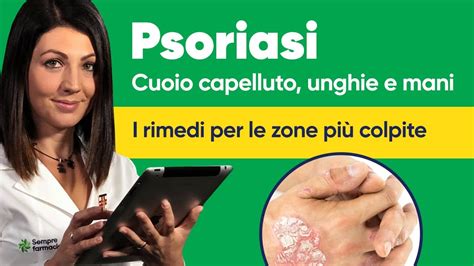 Psoriasi Cuoio Capelluto Unghie E Mani I Rimedi Per Le Zone Pi