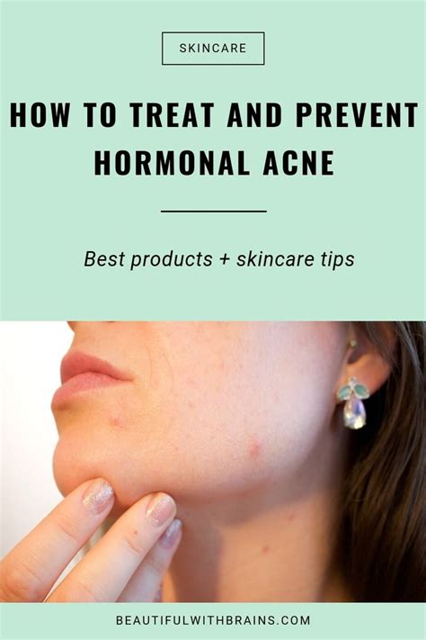 The Ultimate Guide To Dealing With Hormonal Acne Dry Acne Prone Skin