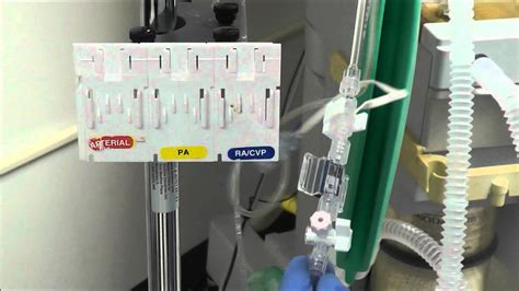 How To Setup An Arterial Line Transducer Youtube