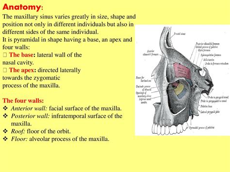 Maxillary Sinus Boundaries