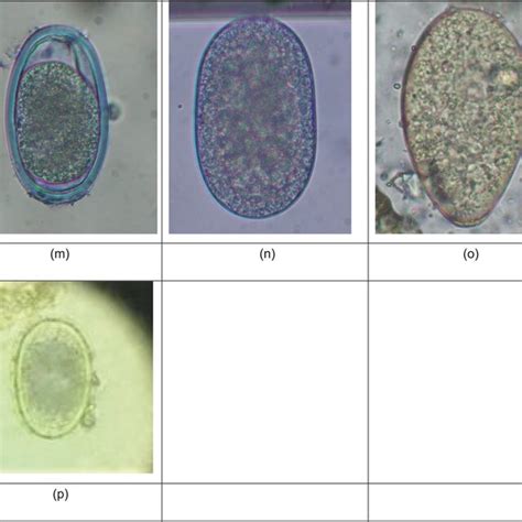 Enterobius Vermicularis Eggs Source From Ref 32 Download Scientific Diagram