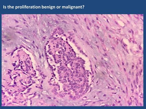 07 histology, cytology and biomarkers in pleural diseases | PPT