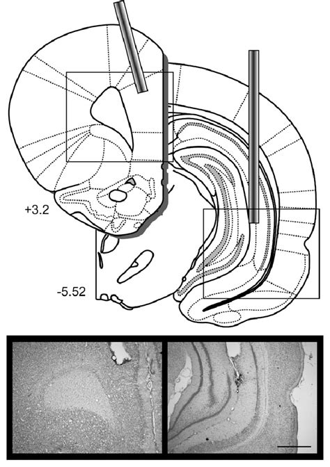 Disconnection Of The Ventral Hippocampus From The Prelimbic Mpfc In