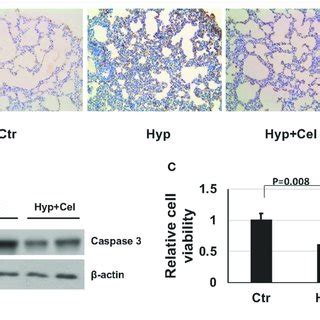 Celecoxib Alleviated The Hyperoxia Induced Lung Inflammation In