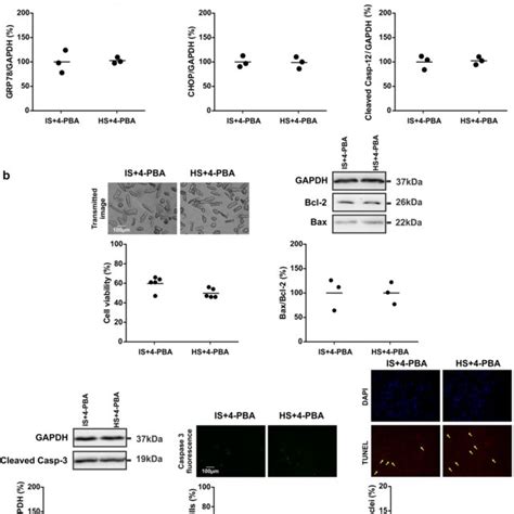 Mild Hyperosmotic Stress Promotes Endoplasmic Reticulum Stress Induced