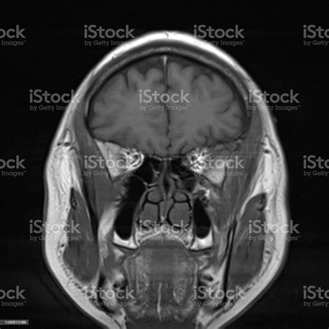 Normal Brain Mri Images Stock Photo Download Image Now Anatomy