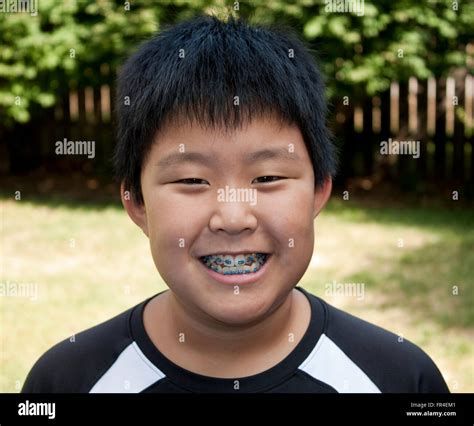 Young Korean Boy Smiling And Showing His Braces Stock Photo Alamy